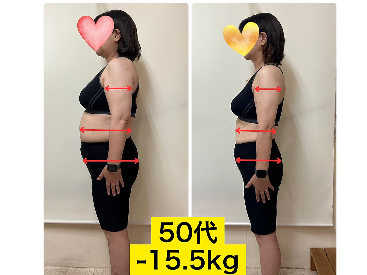 痩身ダイエットでのお客様変化例（50代-15.5kg）